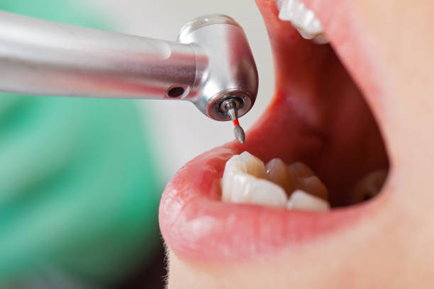 Best Lost Filling or Crown Replacement in Wynne, AR